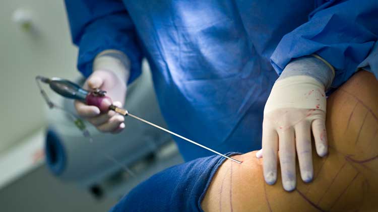 surgeon risk